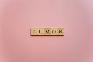Pimicotinib Shows Lasting Tumor Responses and Functional Gains in TGCT