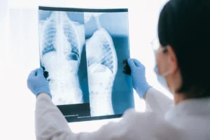 RevBio Awarded $2.2M NIH Grant to Advance TETRANITE® for Spine Fracture Treatment